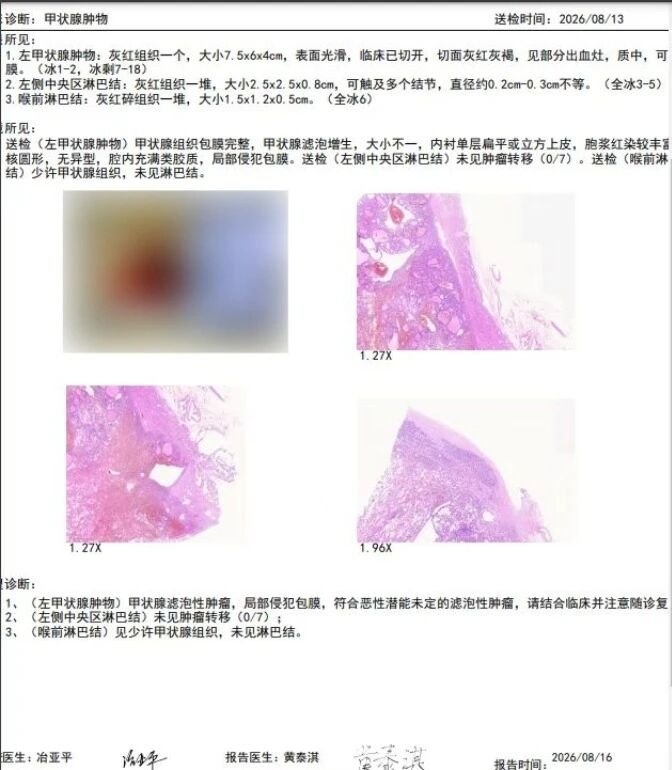 post_image