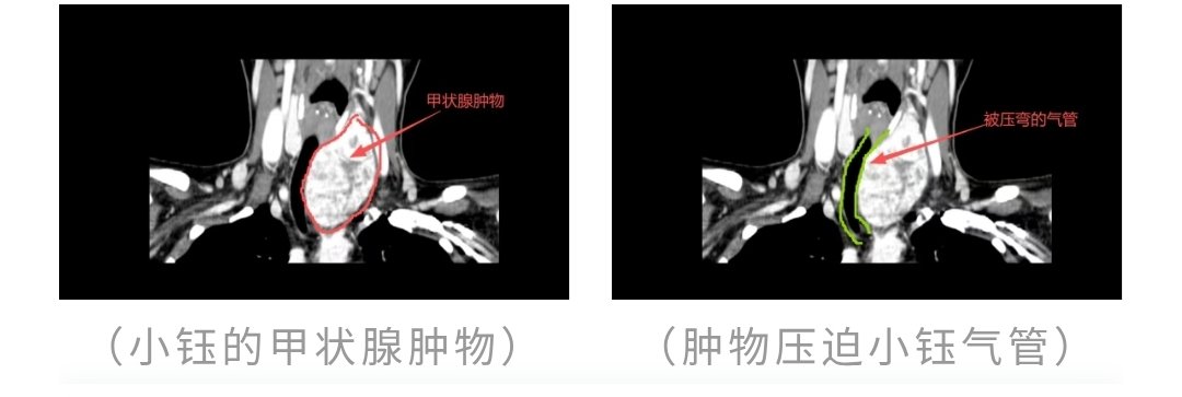 post_image