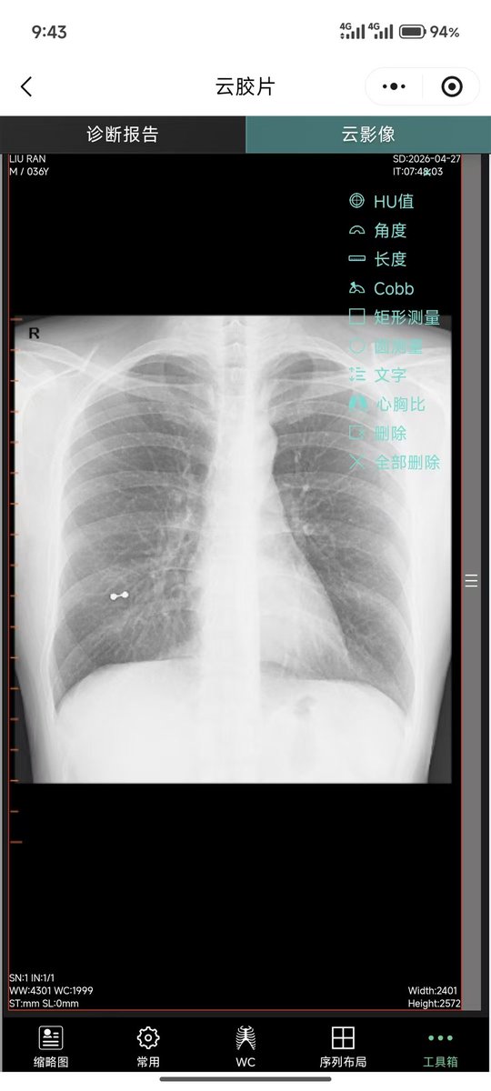 post_image