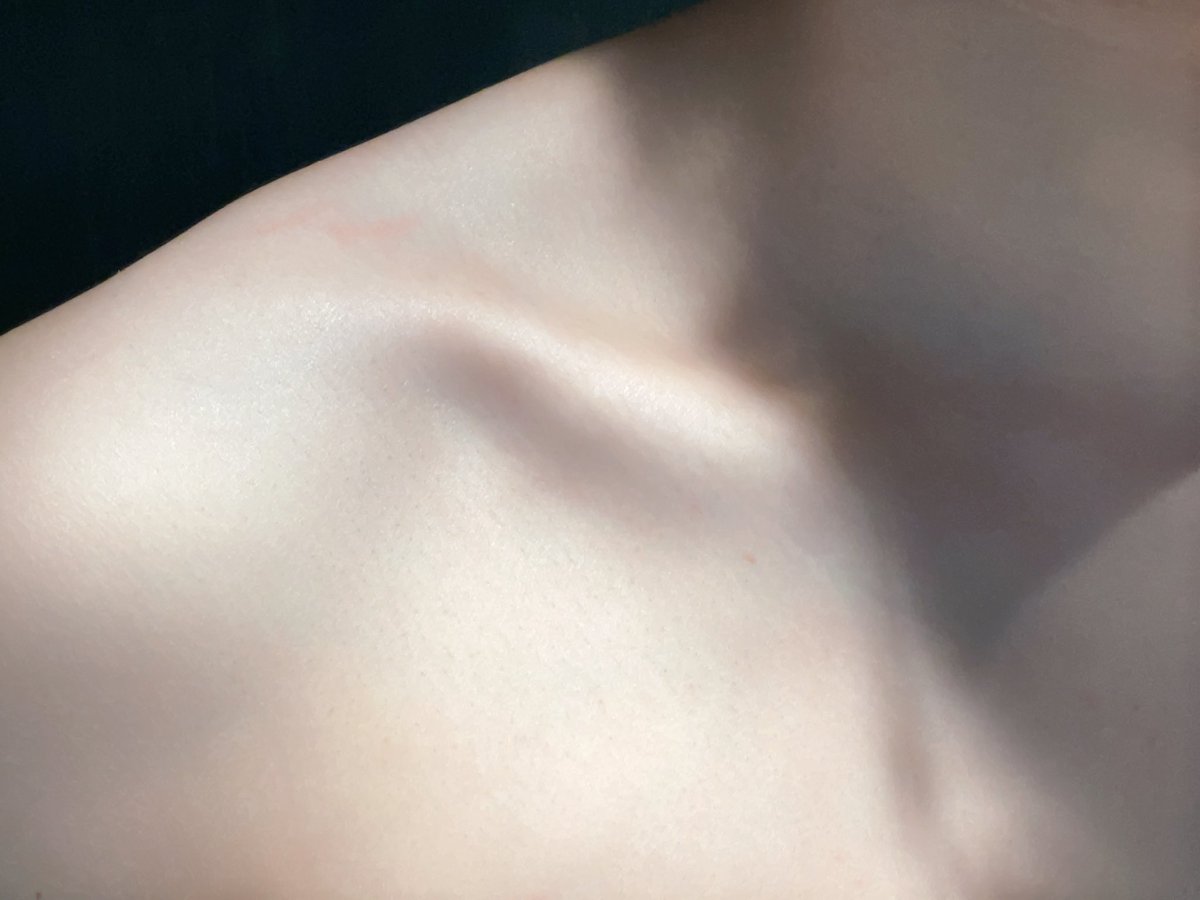 post_image