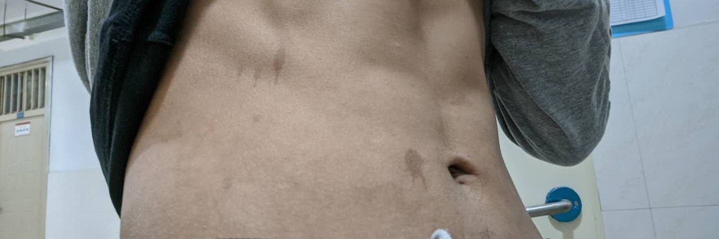 banner